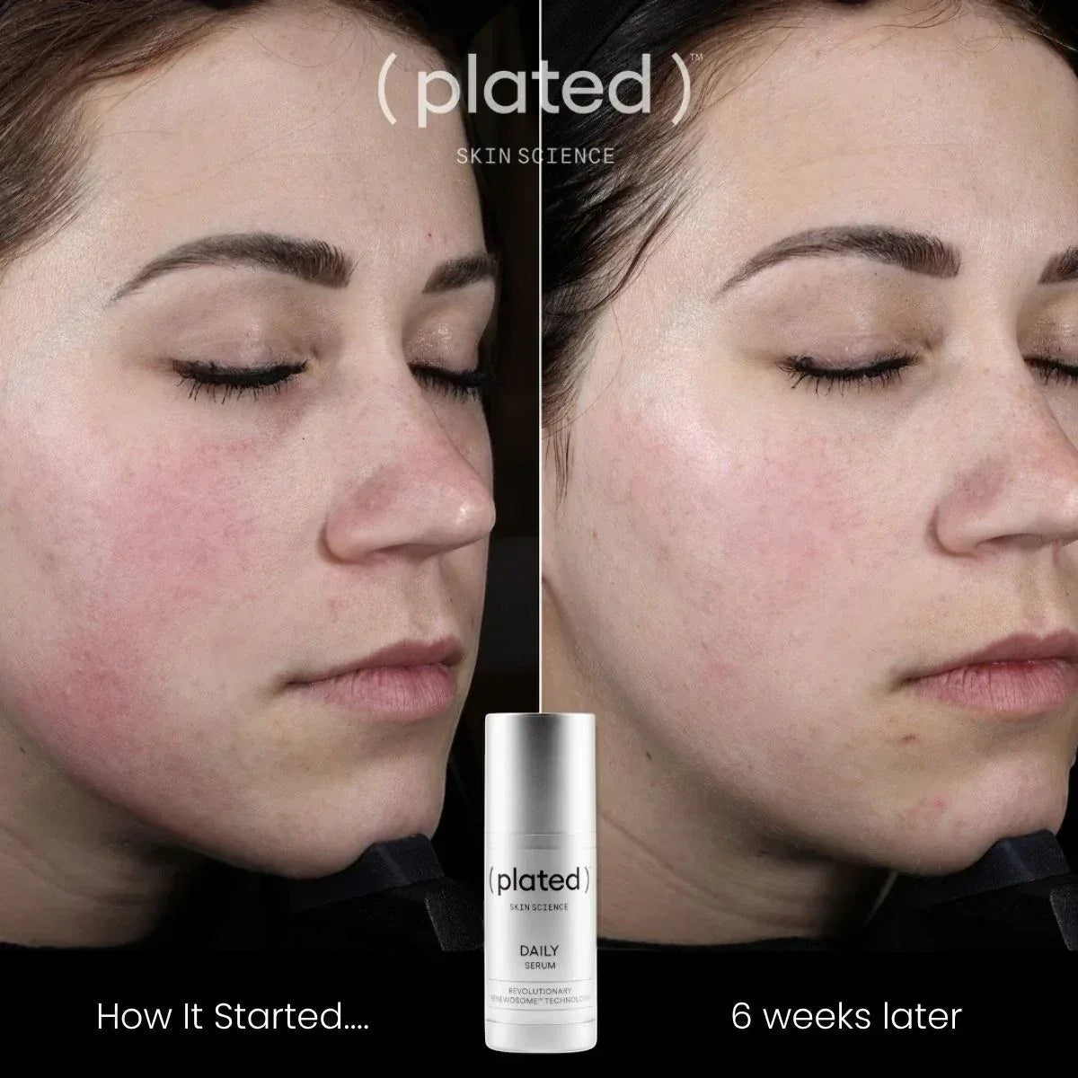Plated Skin Science daily Serum - DermLane