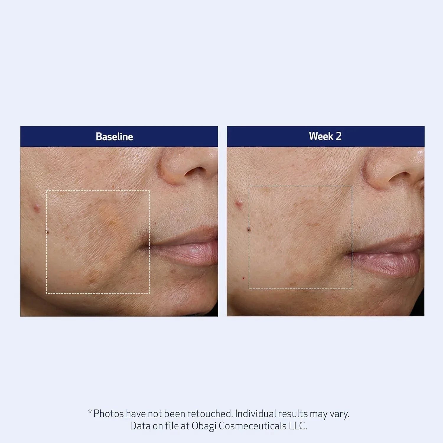 Obagi SuzanObagiMD Super Antioxidant Serum 1 oz - DermLane