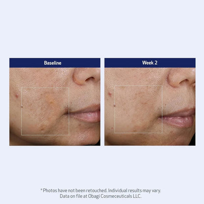 Obagi SuzanObagiMD Super Antioxidant Serum 1 oz - DermLane