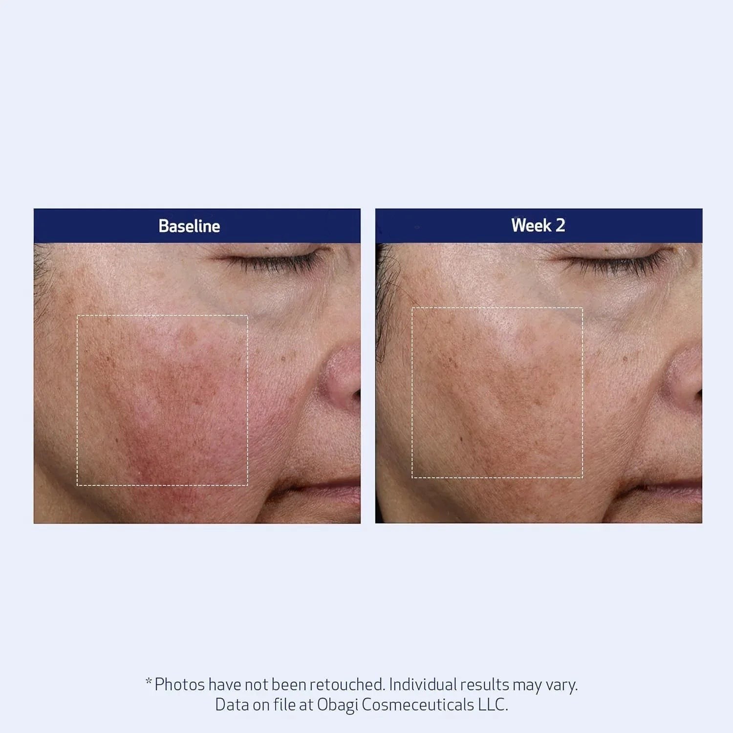 Obagi SuzanObagiMD Super Antioxidant Serum 1 oz - DermLane