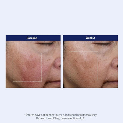 Obagi SuzanObagiMD Super Antioxidant Serum 1 oz - DermLane
