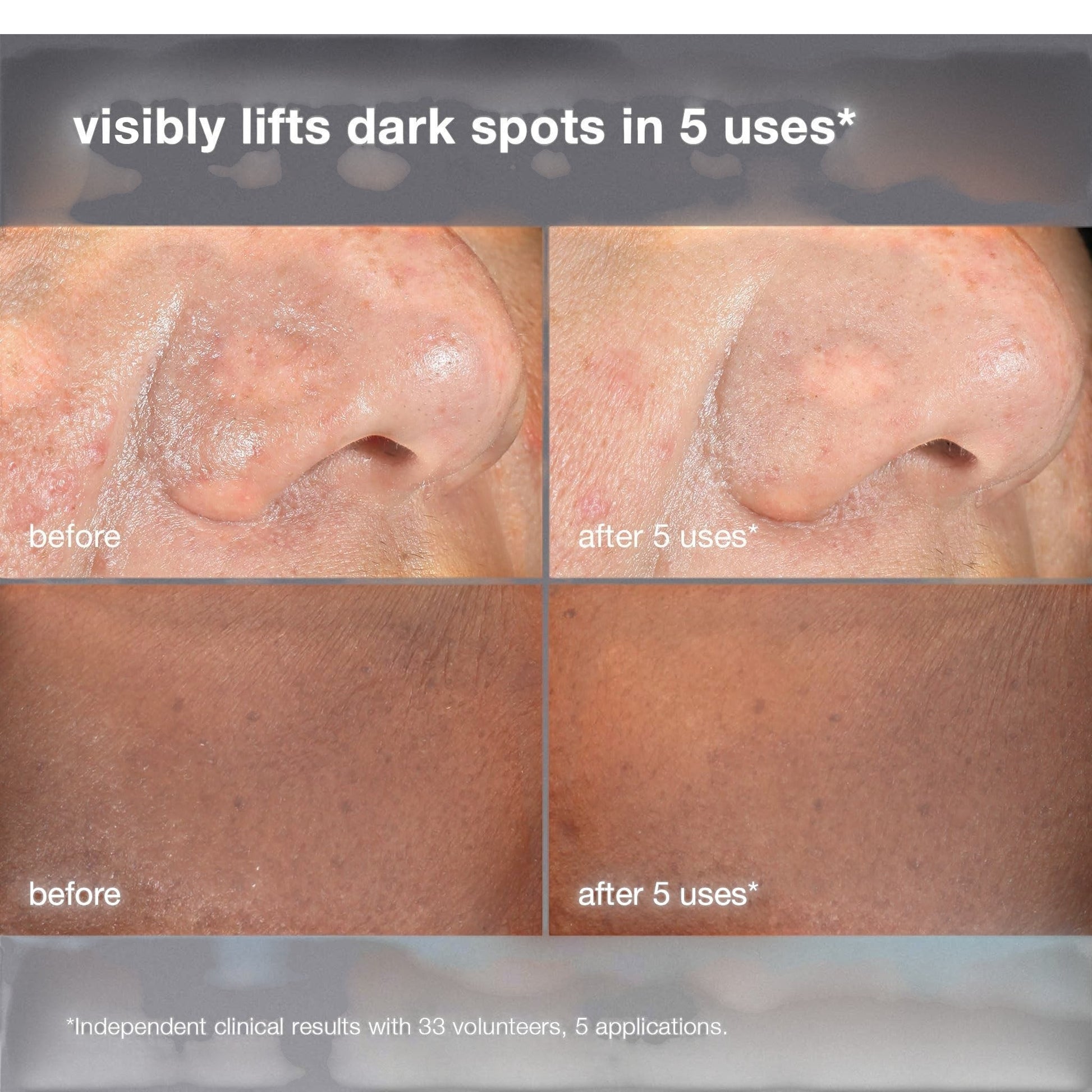 Dermalogica PowerBright Dark Spot Peel