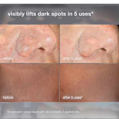 Dermalogica PowerBright Dark Spot Peel
