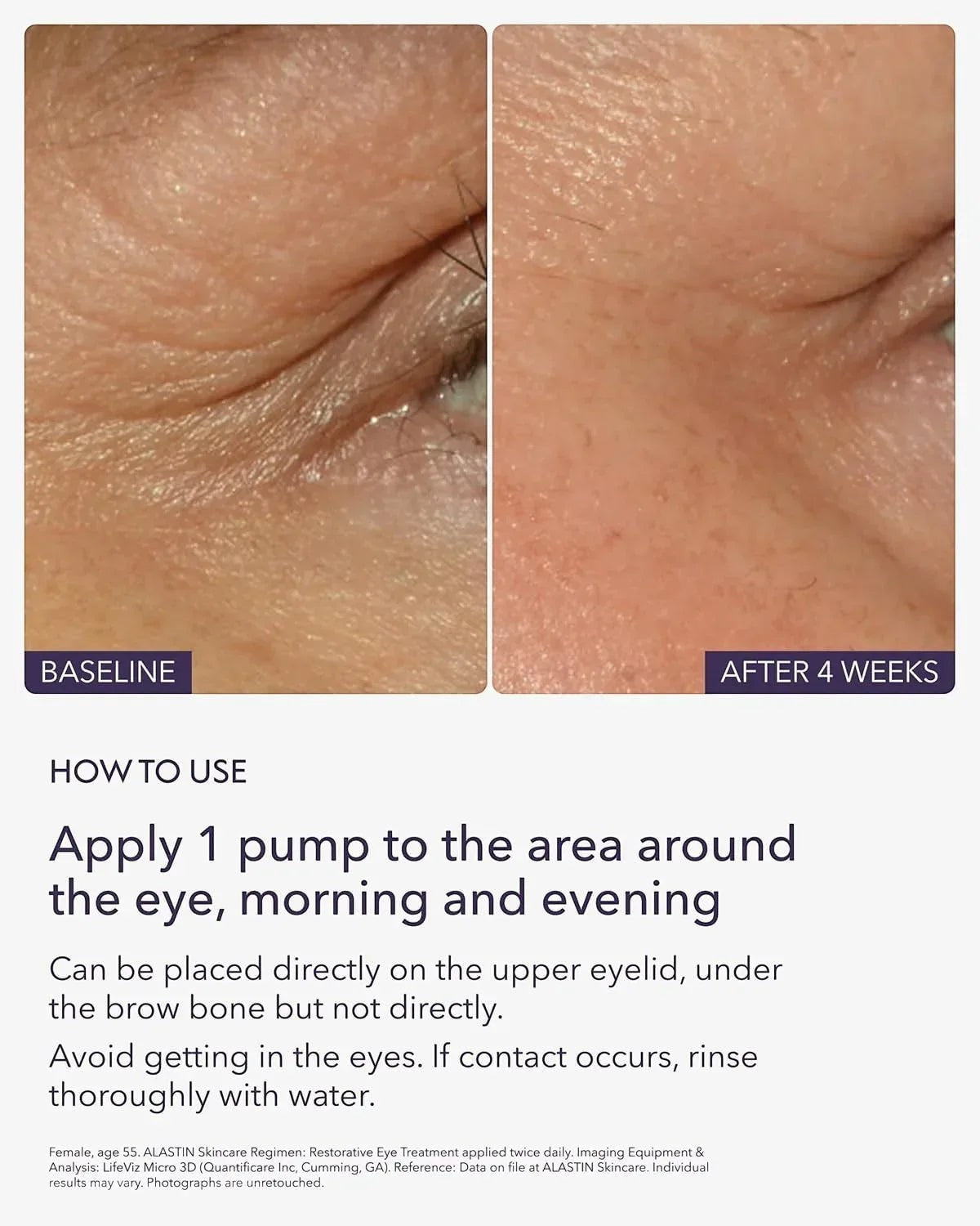 Alastin Restorative Eye Complex with TriHex Technology - DermLane