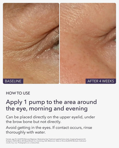 Alastin Restorative Eye Complex with TriHex Technology - DermLane