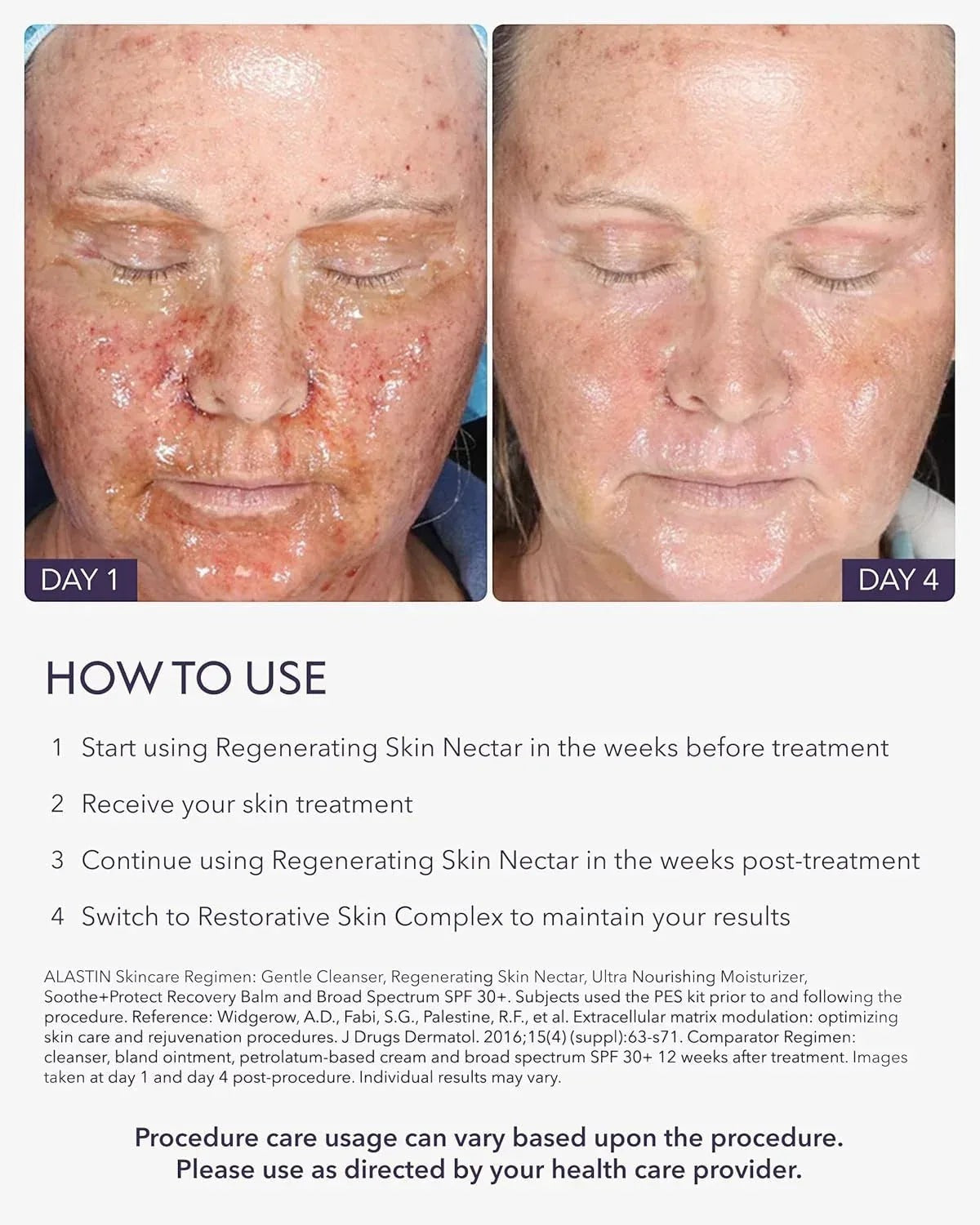 Alastin Regenerating Skin Nectar - DermLane