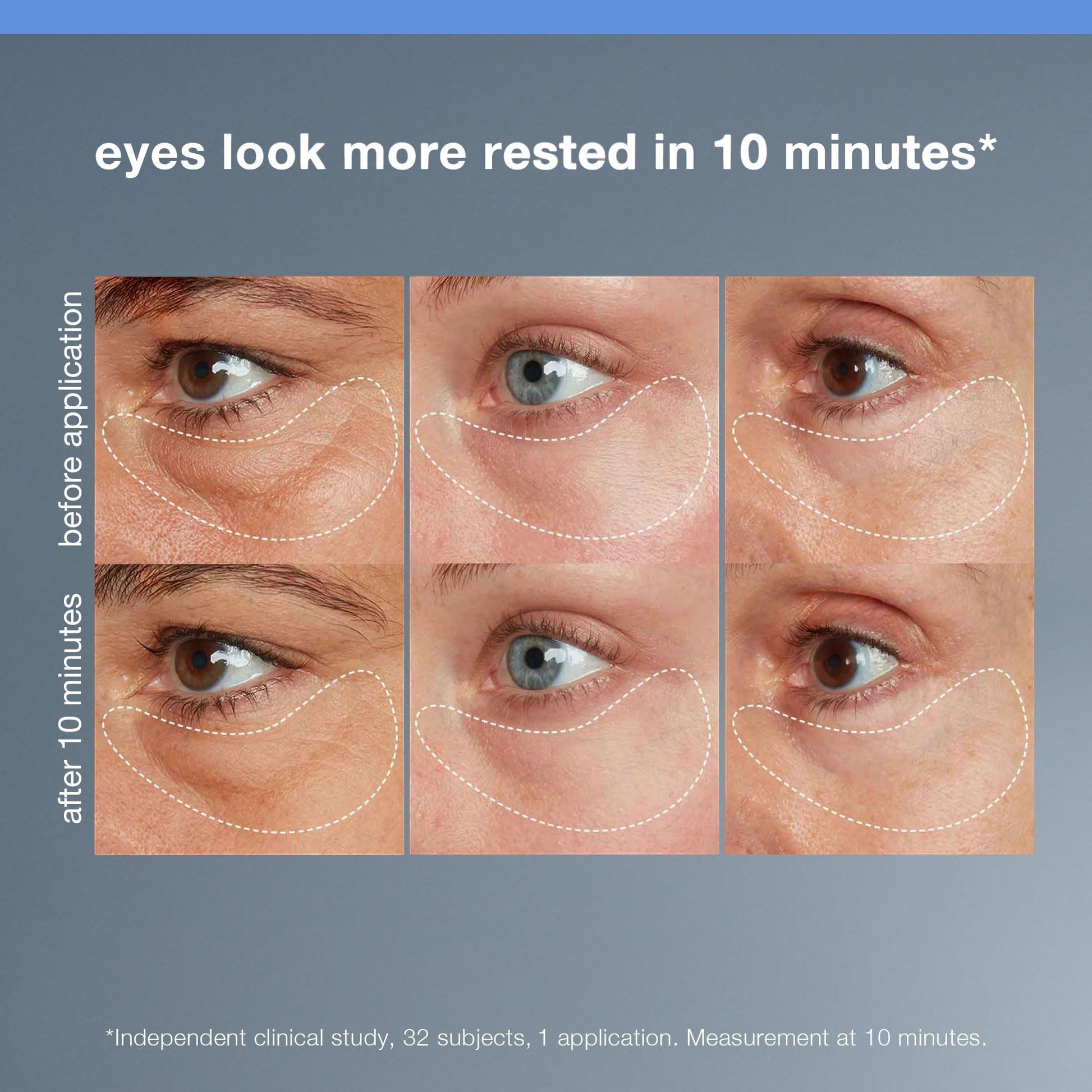 Dermalogica Awaken Peptide Depuffing Eye Gel Eye Treatment