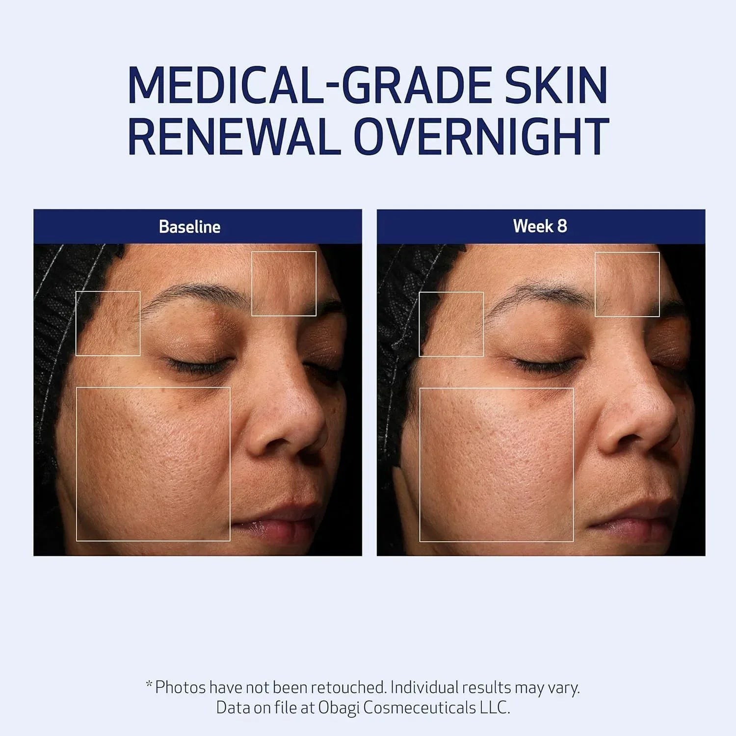Obagi Retinol + PHA Refining Night Cream 1.7 fl oz - DermLane