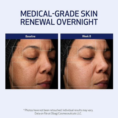Obagi Retinol + PHA Refining Night Cream 1.7 fl oz - DermLane