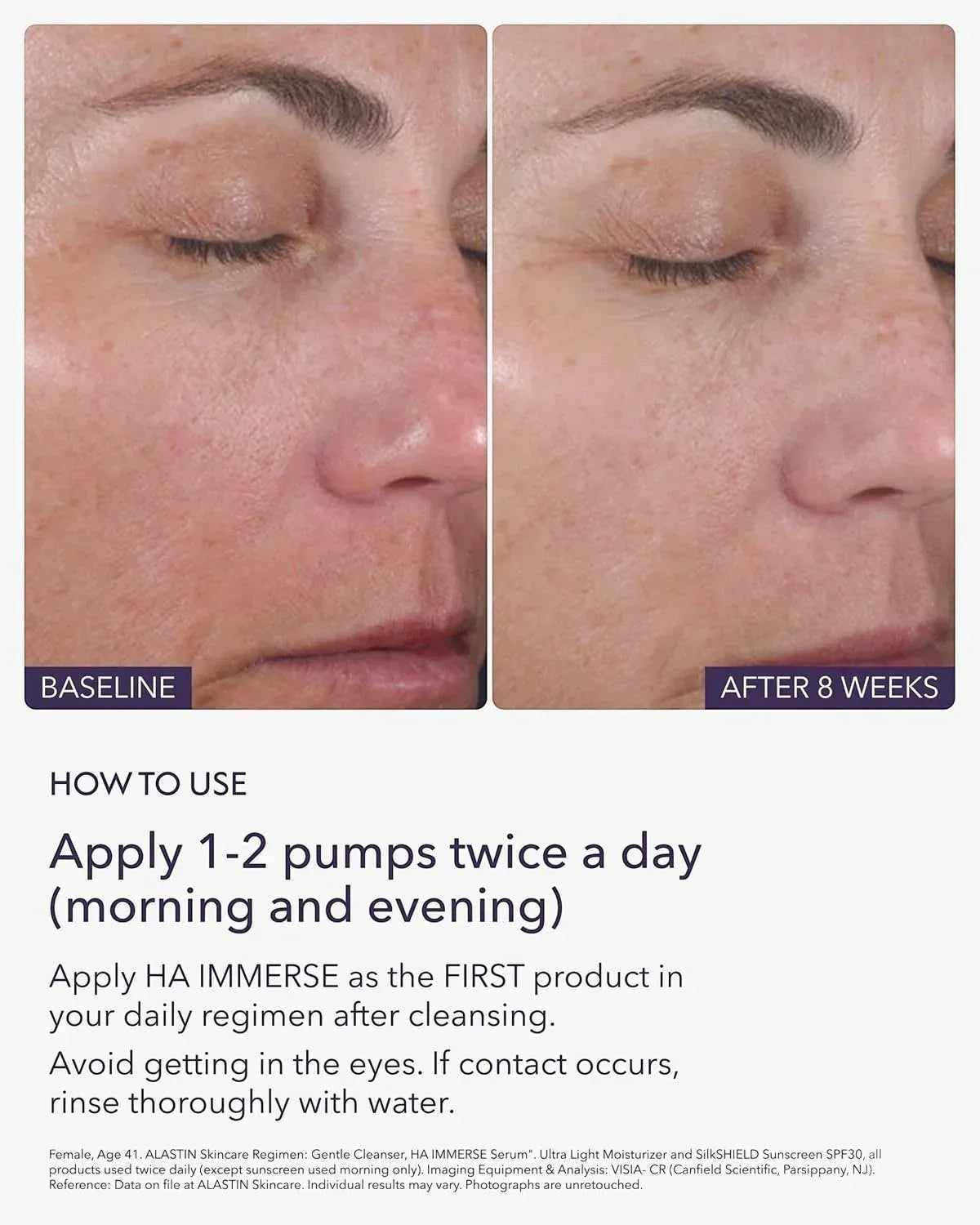 Alastin HA Immerse Serum - DermLane